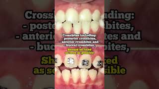 Can braces fix a crossbite Toothtime Family Dentistry New Braunfels [upl. by Broida]