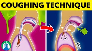 Does Acid Reflux affect the throat Prevention amp Treatment  Dr Harihara Murthy  Doctors Circle [upl. by Eleda]