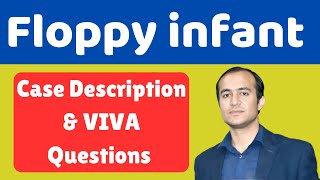 Floppy Infant Case Discussion amp Viva Questions  FCPS MD MCPS MRCPCH Exam Prep [upl. by Wheelwright560]