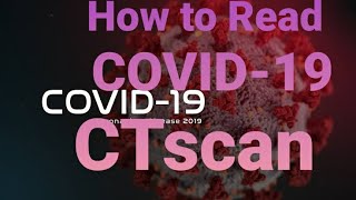 HOW TO READ COVID19 CHEST CT SCAN  RADIOLOGY  ASIF MALIK [upl. by Sterne]