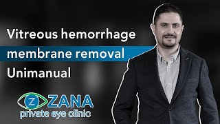 Vitreous hemorrhage membrane removal unimanual [upl. by Isaiah]