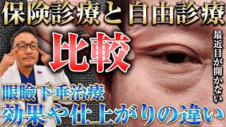 【保険適応】やった後に後悔する。眼瞼下垂治療の違いについて医師が解説します。【保険外】 [upl. by Zevahc]