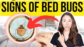 What Bed Bugs Bites Really Look like  Identifying Bed Bug Bites [upl. by Leanna]