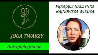 PĘKAJĄCE NACZYNKA NAJNOWSZA WIEDZA [upl. by Noled]