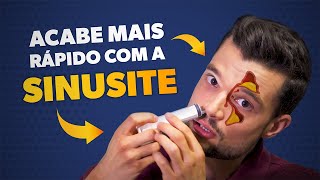 🔥Como Tratar sua Rinite Alérgica SEM Medicações Otorrino explica [upl. by Marilee]