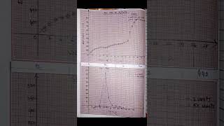 Potentiometric Titration of Fe2 with K2Cr2O7 chemistryexperiments [upl. by Aisad458]