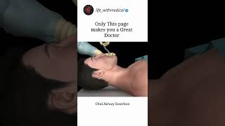 Oral Airway insertion doctor medical neet biology anatomy [upl. by Ardeed196]