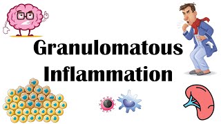 Granulomatous Inflammation  Types Pathophysiology Different Cell Types In Granuloma amp Examples [upl. by Adnaral]