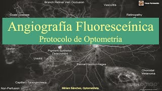 Angiografía Fluoresceínica Protocolo de Optometría [upl. by Bernie937]