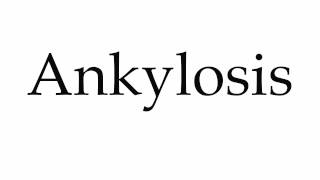 How to Pronounce Ankylosis [upl. by Ahsinned273]