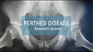 Perthes Disease Research Update  webinar [upl. by Sholem]