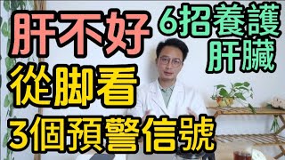 肝有問題，脚先知！脚上出現3個預警信號時，説明你的肝臟出現病變。醫生教你6招養護肝臟。 [upl. by Ennayelhsa]