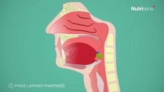 Dysphagie troubles de la déglutition et Fausse route questce que cest [upl. by Kass]