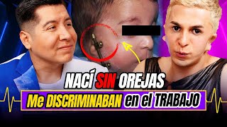 ¡NACÍ SIN OREJAS👂 TENGO SÍNDROME de TREACHER COLLINS  Diagnóstico 59  Mr Doctor [upl. by Hardan]