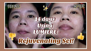 MY LUMIERE SKIN VITALS REJUVENATING SET EXPERIENCE  After 14 days ReviewFeedback ✨ [upl. by Kcaj445]