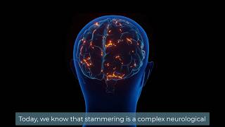 How is stammering addressed Now  today vs past [upl. by Irving]