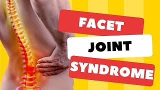 Top 3 Signs Your Back Pain is Facet Joint SyndromeSymptoms amp Signs [upl. by Nawor]