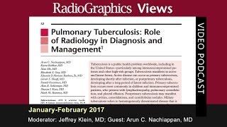 Pulmonary Tuberculosis Role of Radiology in Diagnosis and Management [upl. by Imeaj]