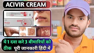 Acivir cream uses dose benefits and Side effects full review in hindihow to use acivir cream [upl. by Neruat]