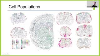 Cellular architecture of evolving neuroinflammatory lesions and multiple sclerosis pathology [upl. by Mayer]