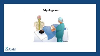 Myelogram [upl. by Yedok]