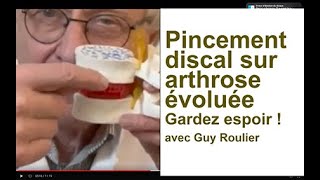 Pincement discal arthrose douloureuse gardez lespoir par Guy Roulier [upl. by Cannell]