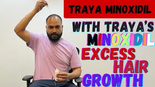 Pro Tips Optimize Hair Growth with Traya Minoxidil [upl. by Lotz]