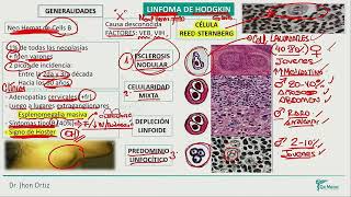 Hematología  Linfoma de hodgkin linfoma no hosgkin mieloma multiple sindrome de lisis tumoral [upl. by Maidy]