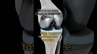 How to Stretch Total Knee Replacement with Ankle Weight [upl. by Serica]