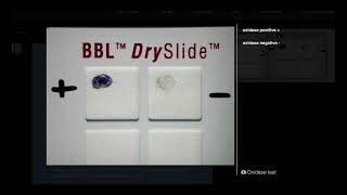 Oxidase Test DrySlide  Microbiology [upl. by Ivy]