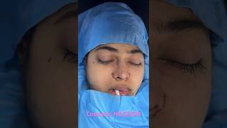 Best Cosmetic Facial Plastic Surgery of the NOSE Job in India  pretty girl Rhinoplasty by Dr R [upl. by Cappella60]