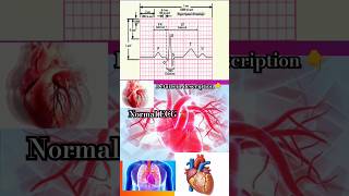 normal🫀ecg🫀heart🫀p QRS t Wave🫀heartattack🫀heart disease🫀viralshorts🫀yt shortsmbbsdoctor [upl. by Notnroht]