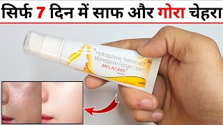 Melacare Cream Review in Hindi मेलाकेयर क्रीम के फायदे नुकसान उपयोग [upl. by Atiuqat753]