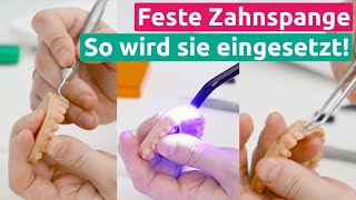 Feste Zahnspange So wird sie in den Mund eingesetzt [upl. by Enela]