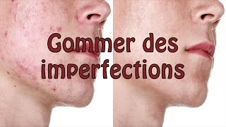 PHOTOSHOP Tutoriel  Gommer des imperfections acné etc dun visage [upl. by Yellah]