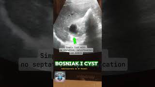 BOSNIAK I Cyst fy radiological fypyoutube radiologist science [upl. by Ardied532]