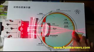 long sightedness and short sightedness demo [upl. by Pepita]