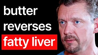 The FASTEST Way To Fix Fatty Liver Naturally 10 COMMON Symptoms Dr Ken Berry [upl. by Hildagard635]