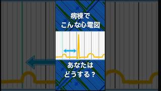 病棟でこんなモニター心電図、あなたはどうする？part9 心電図検定 看護師 [upl. by Bravar932]