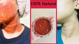 How to Reduce Uneven skin tone Sun Burn Acne Scars Discolouration  Home Remedies 100 Natural [upl. by Osborn]