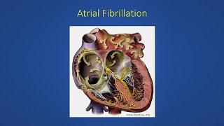 Ectopic heart beats shortness of breath and cough [upl. by Gollin]